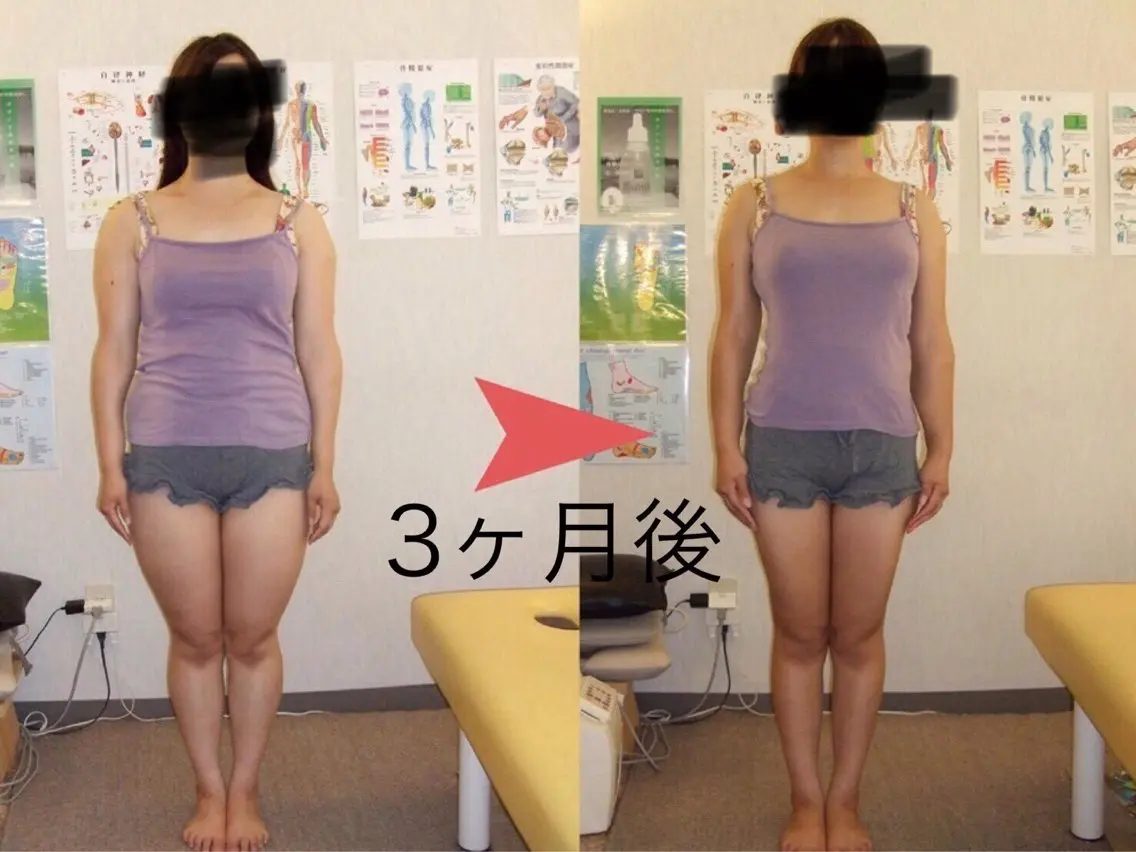 【夏に向けた痩身12回コース】　　　　　　　　　　　　　　　　　高周波温熱美容機＋波動型空気圧美容機＋キャビテーションの写真