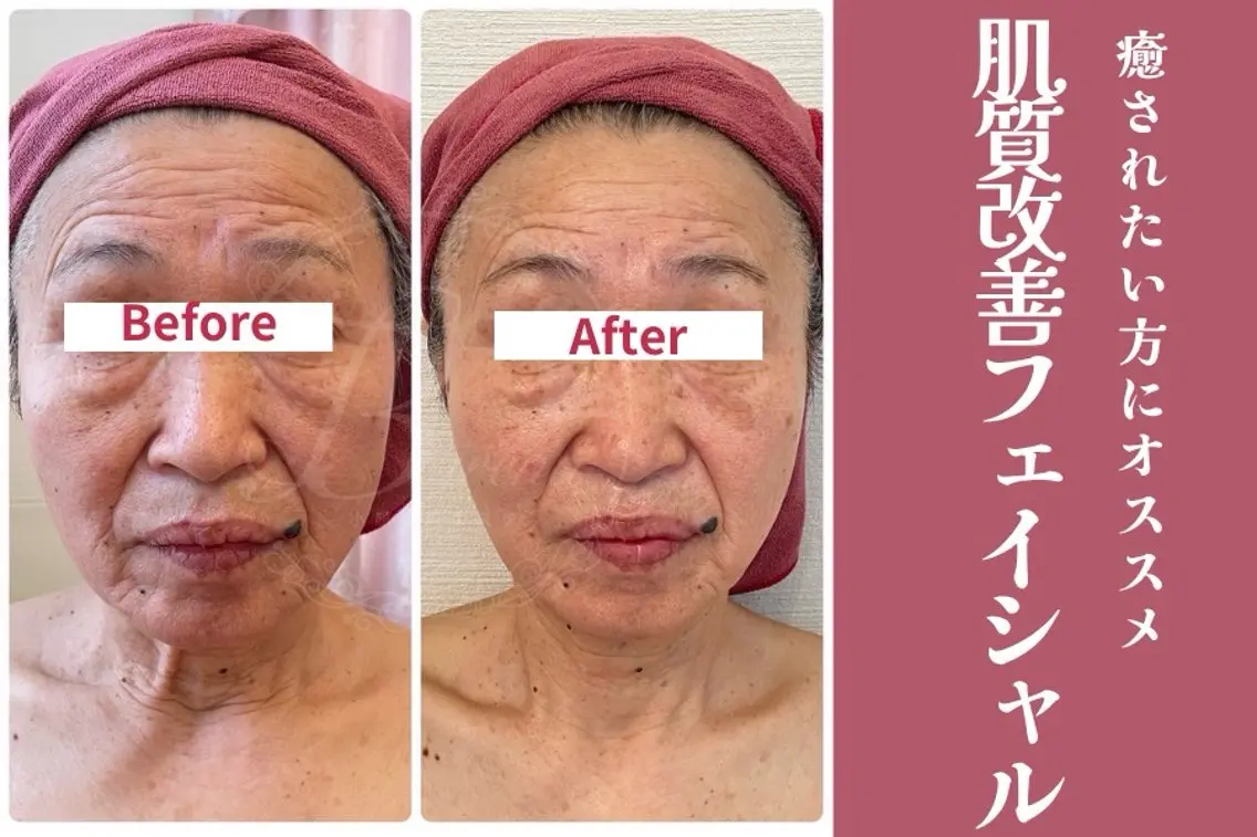 エステ Birena 守谷店 (大崎)のエステ・リラクイメージ