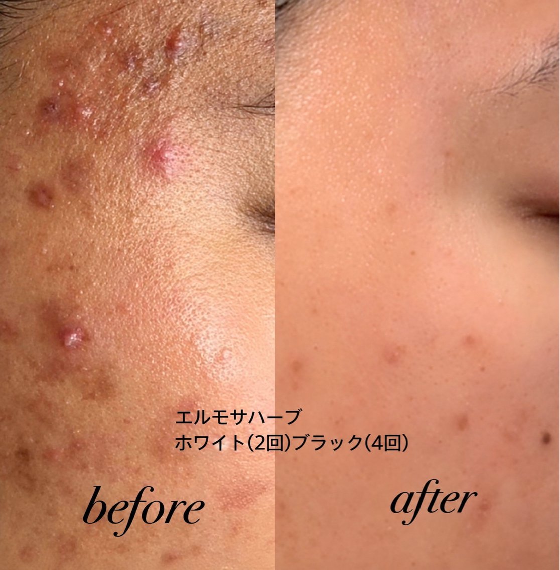 エステ リラク 美肌革命×本格痩身店 癒し隠れ家salonのエステ・リラクイメージ