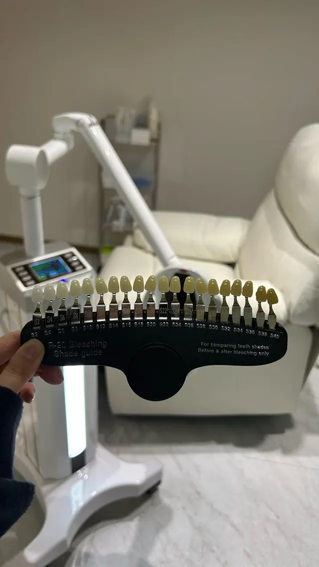 ホワイトニングサロン Bianのその他イメージ