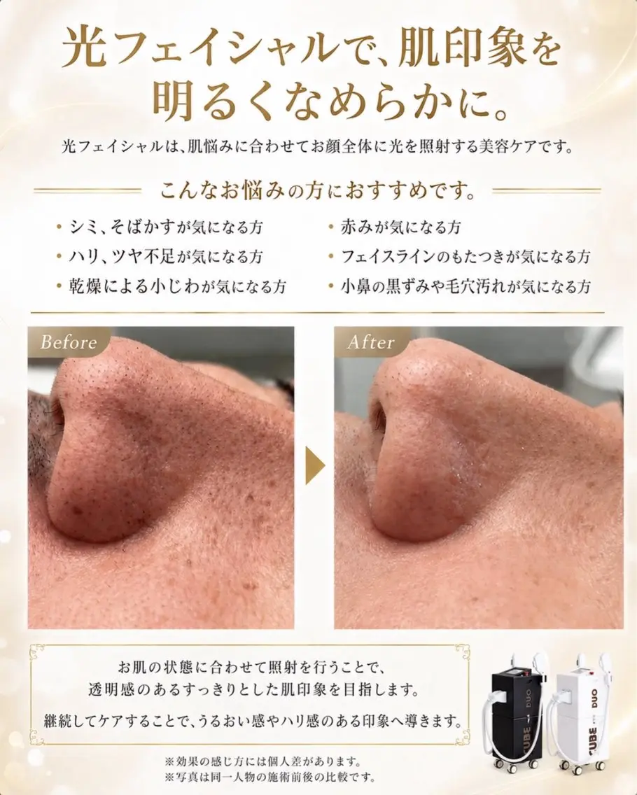 メンズ エステ 脱毛サロン ベル・マタンのエステ・リラクイメージ