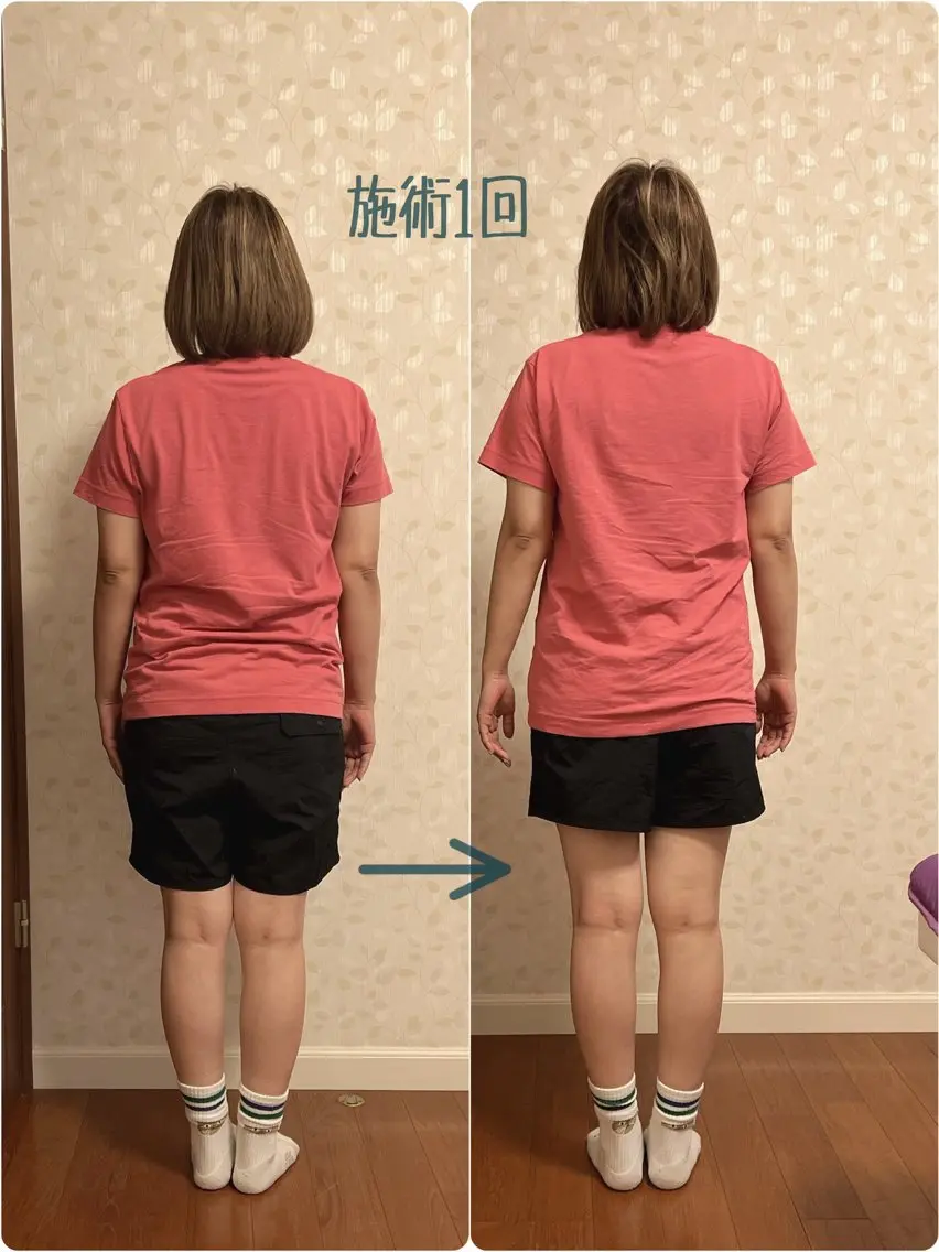 60お試し　歪みを整うの写真