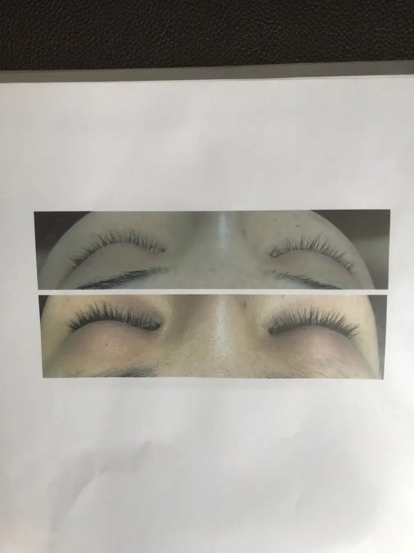 Lashaddictラッシュアディクトまつ毛育毛!の写真