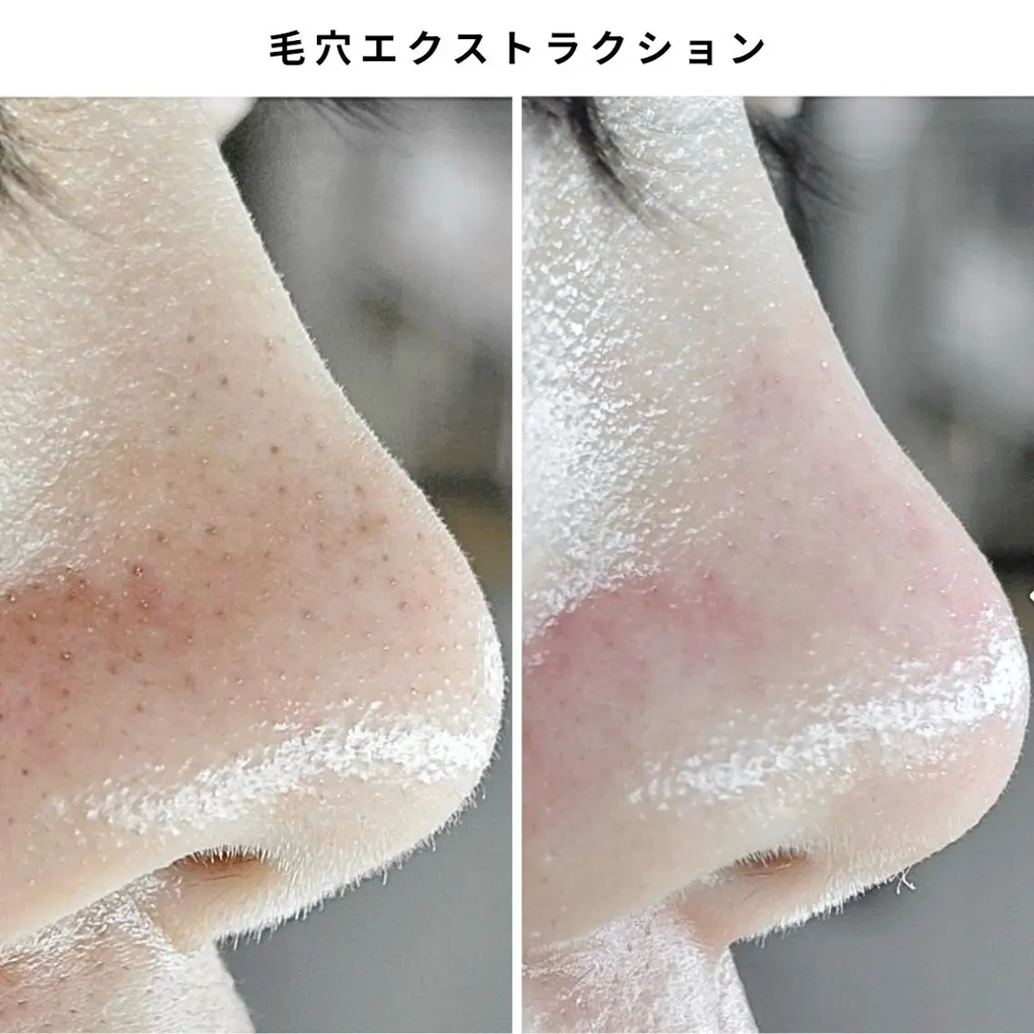 エステ Muqu. 毛穴サロンのエステ・リラクイメージ