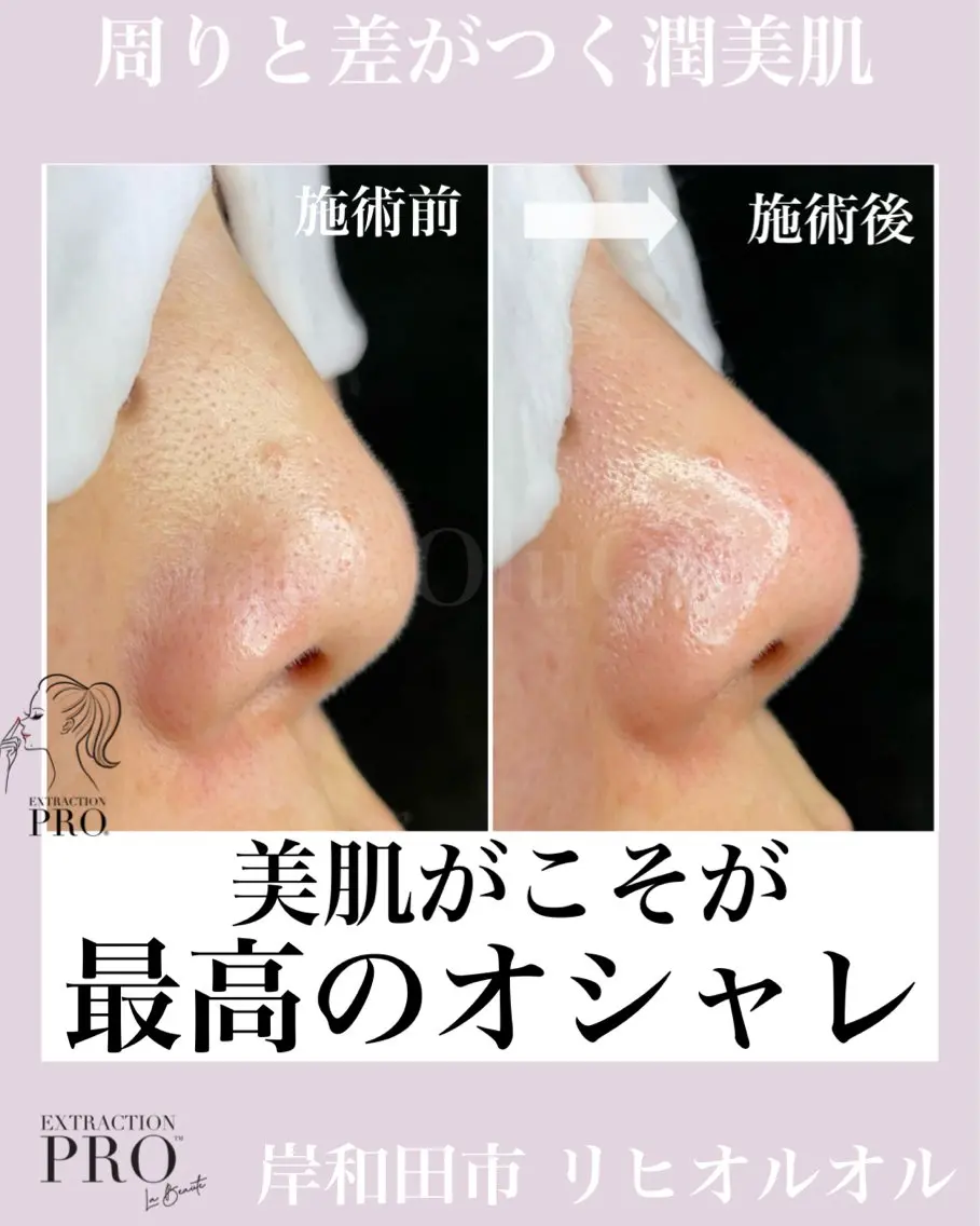毛穴汚れ改善専門店/ 岸和田/リヒオルオルのエステ・リラクイメージ