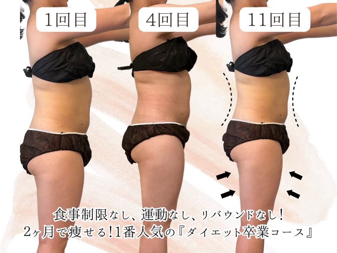エステ リラク YOSAPARK urara大井町のエステ・リラクイメージ