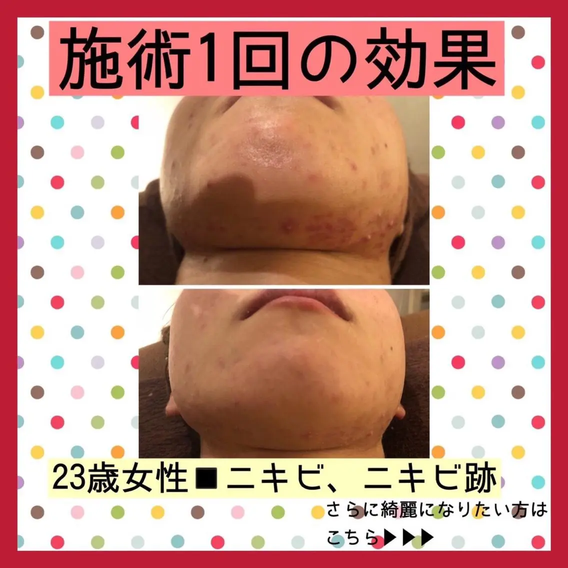 ミディアム カラー パーマ ヘアアレンジ メンズ キッズ ネイル マツエク・マツパ ニキビ・肌質改善専門 ♡人生が変わるサロンのエステ・リラクイメージ