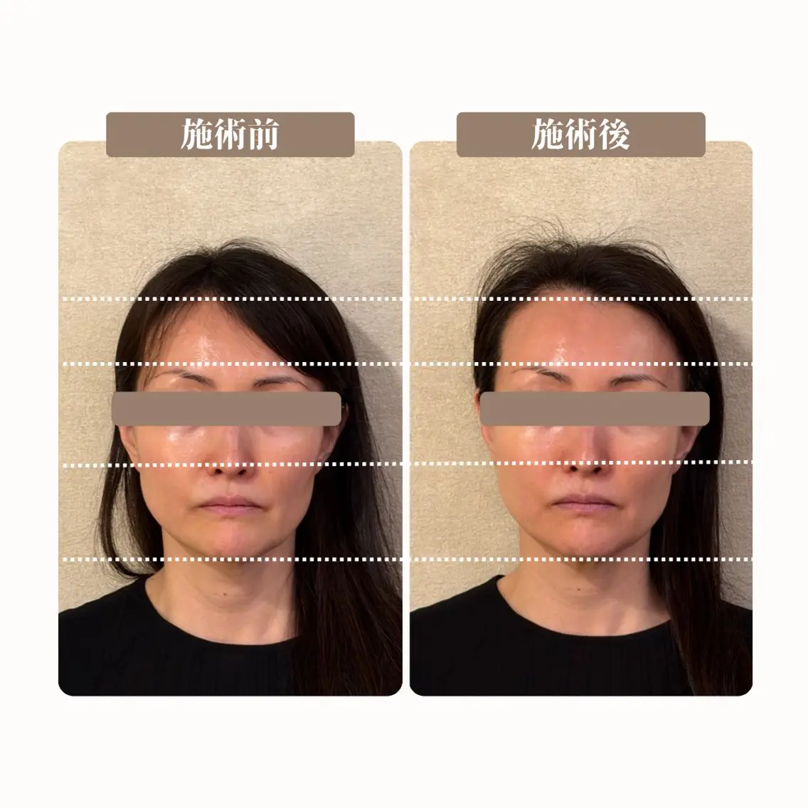 エステ BLANCIA 銀座のエステ・リラクイメージ