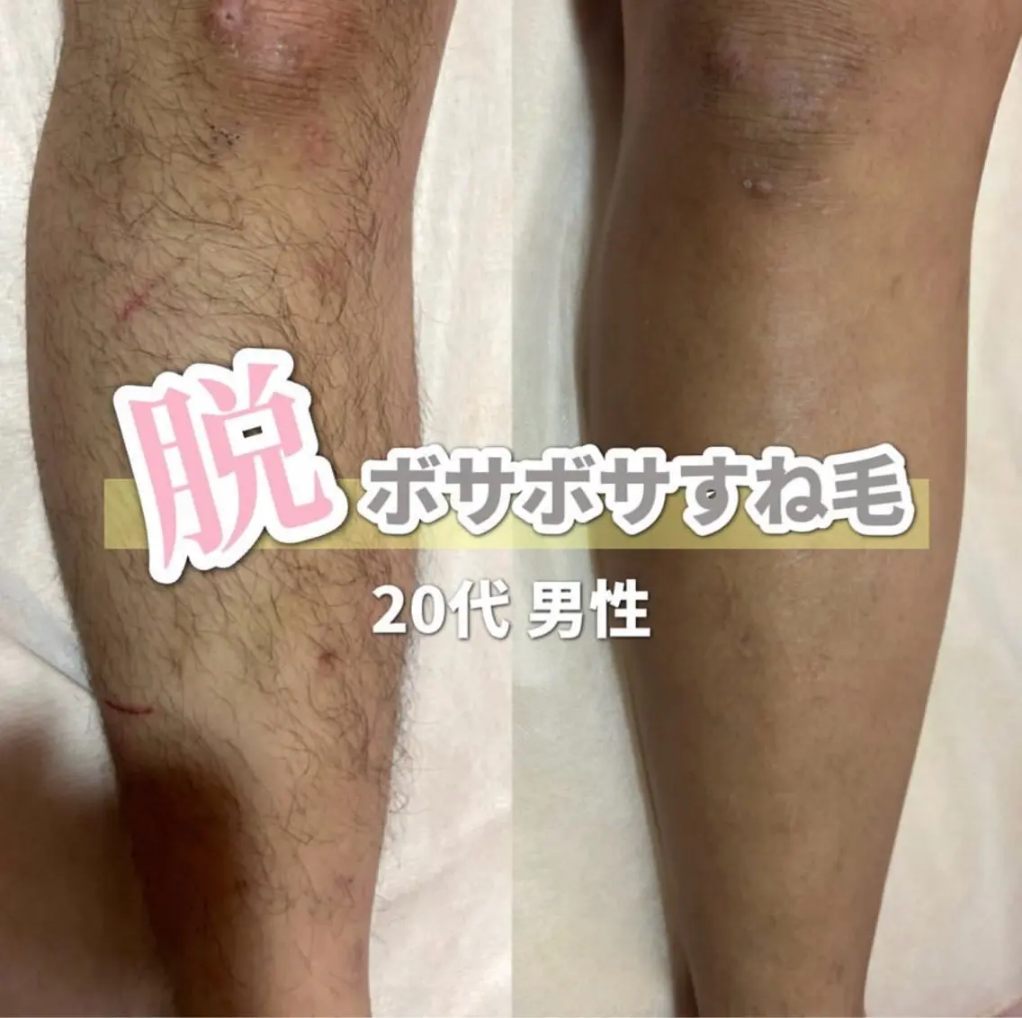 脱毛 SALON韓国肌管理 東別院のエステ・リラクイメージ