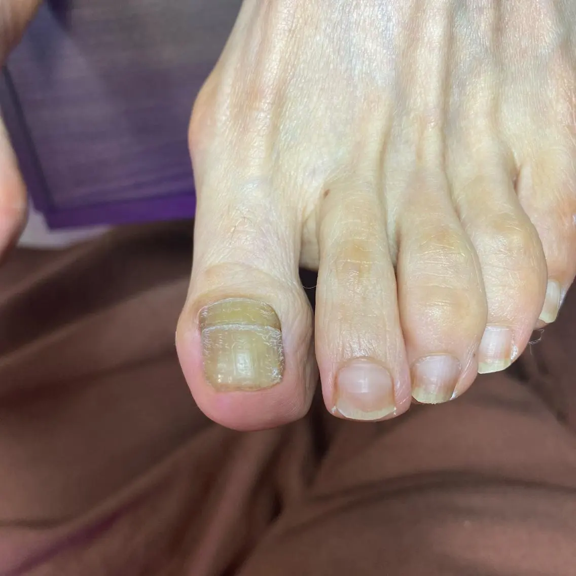 ネイル 久場 晴美のネイルデザイン