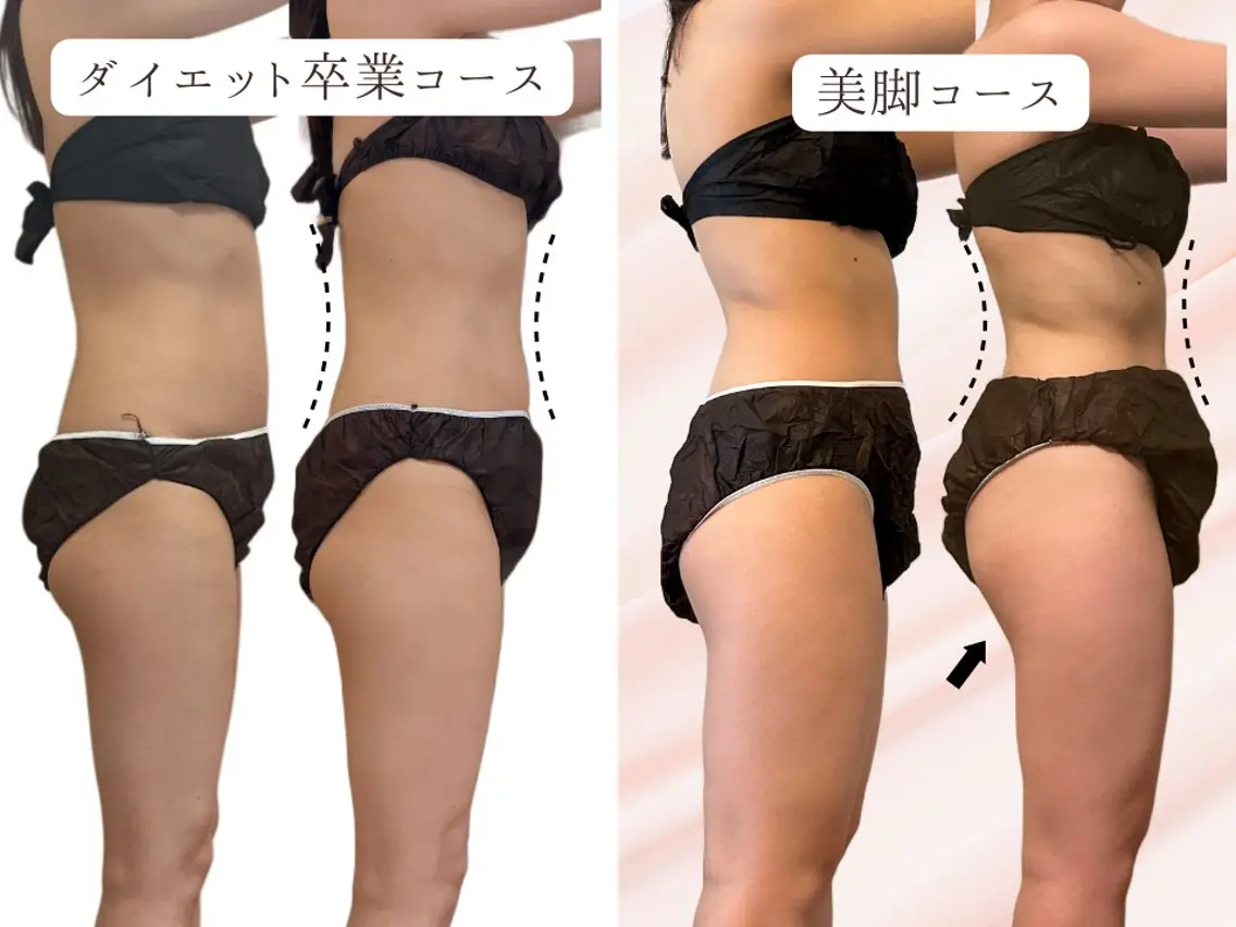 【ルルオンのみ！】まずはココから！燃焼ダイエットコース ￥6000→￥5000円　70分の写真