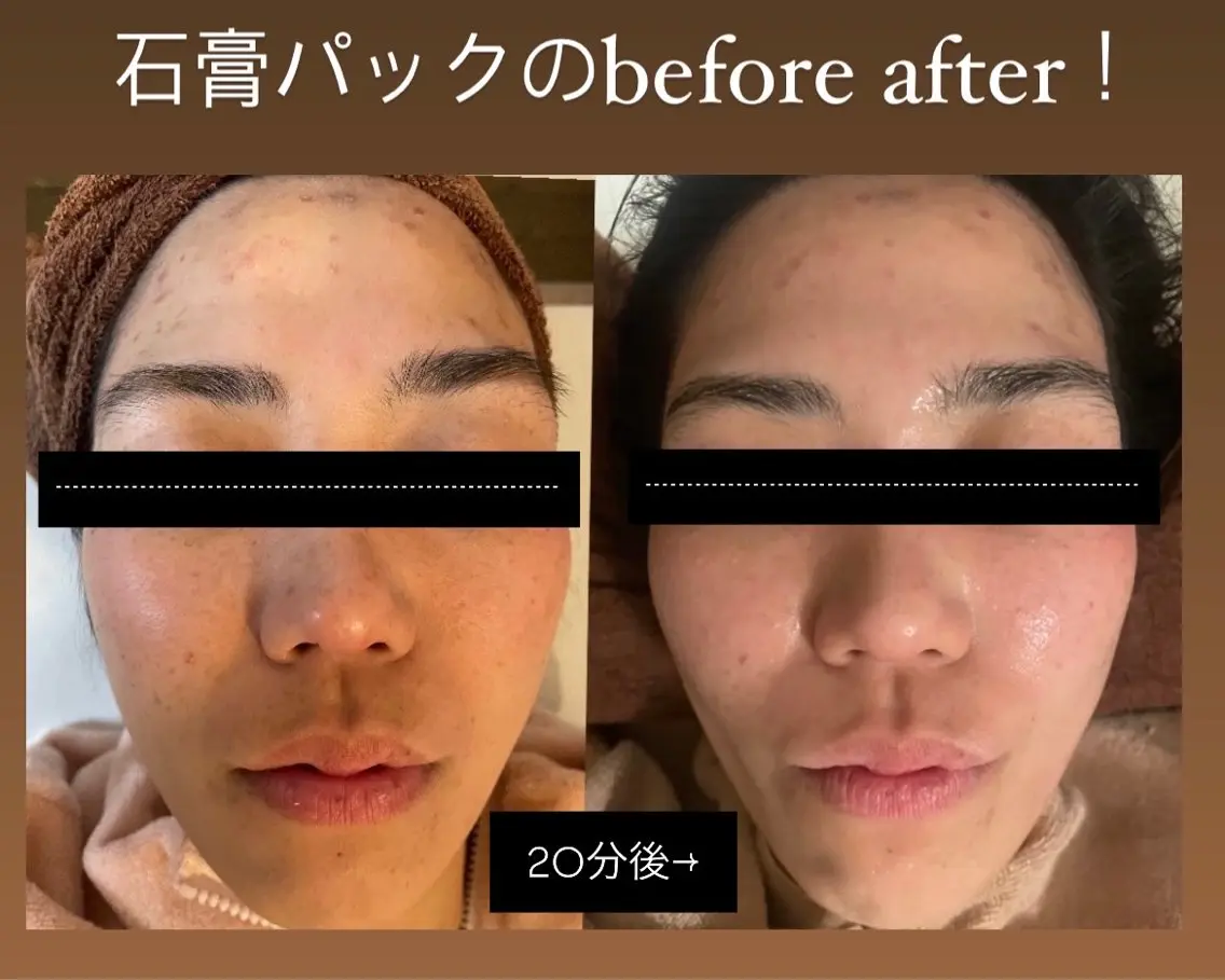 脱毛🌈Beauty Salon新宿店のエステ・リラクイメージ