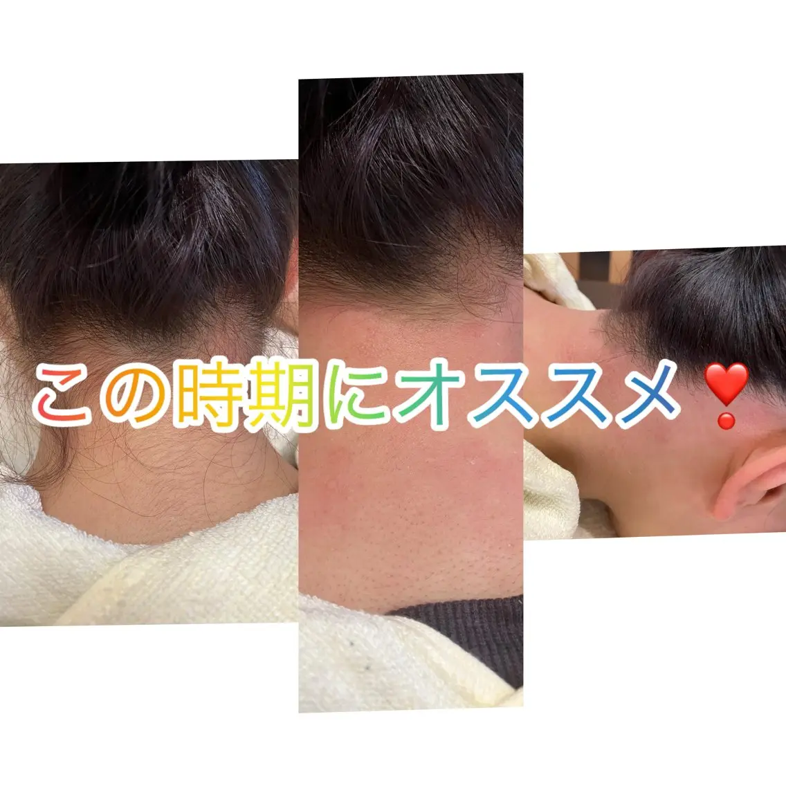 脱毛 caresalon callaのエステ・リラクイメージ