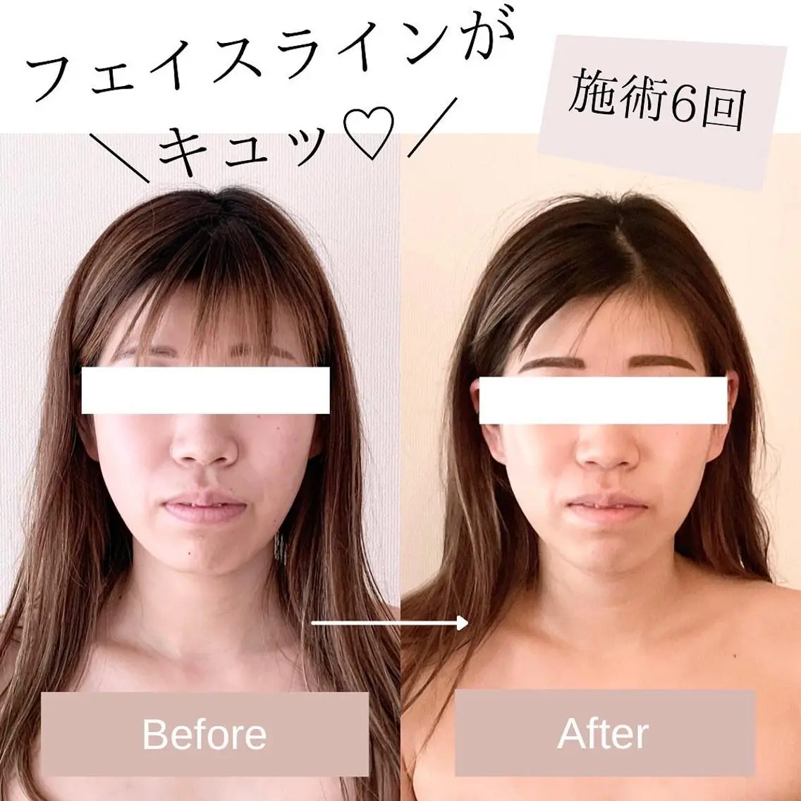 小顔＆美肌 Re :setのエステ・リラクイメージ