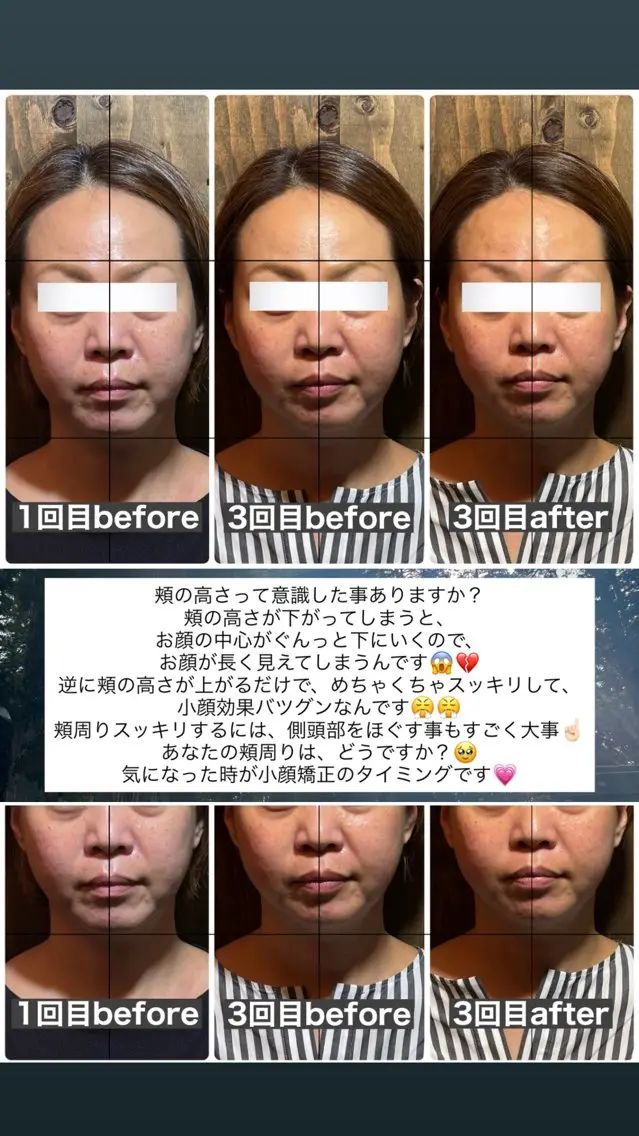 エステ リラク 💎後悔させない小顔 矯正💎イトヤマ🌱のエステ・リラクイメージ
