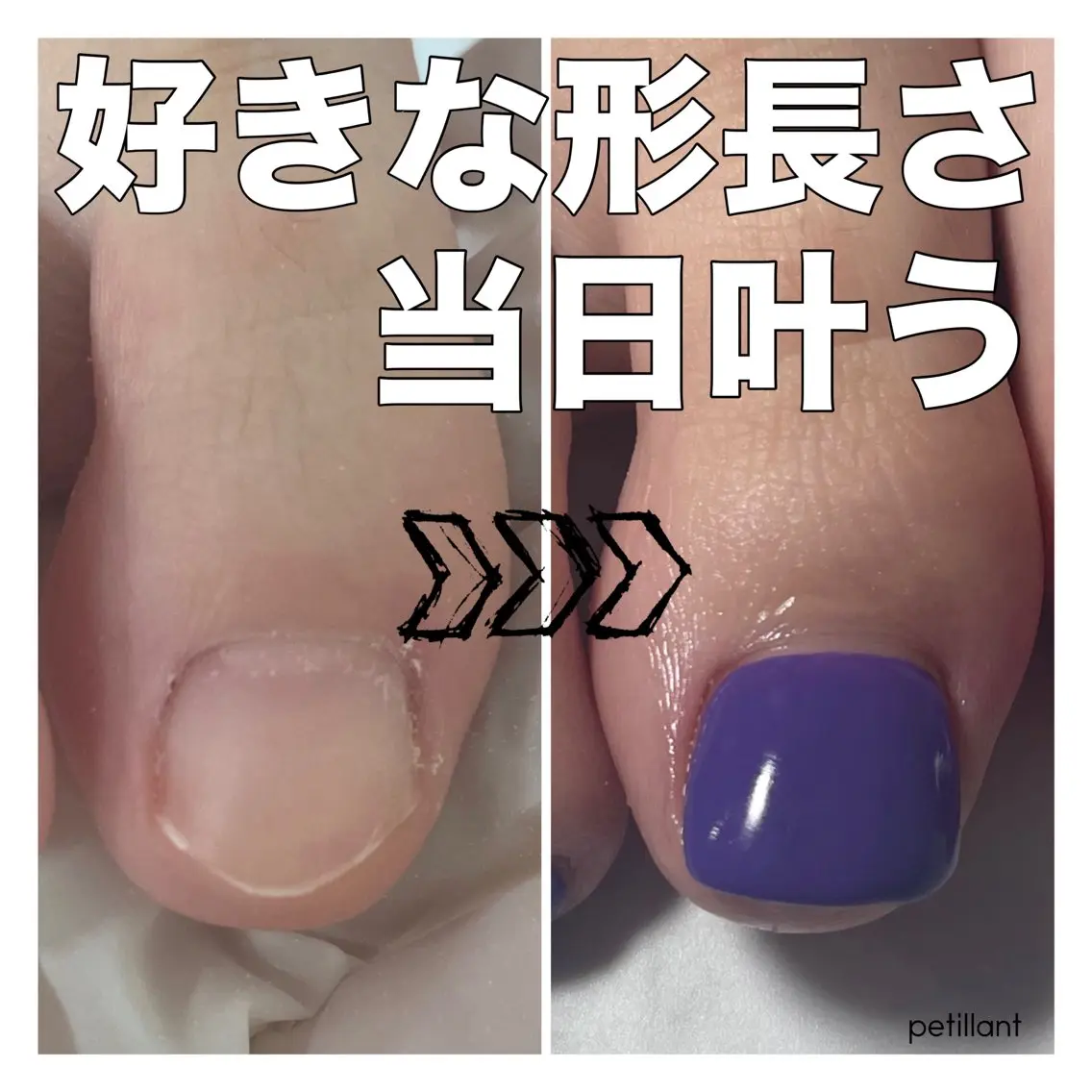 ネイル フットネイル フットネイル nail salon petillantのネイルデザイン