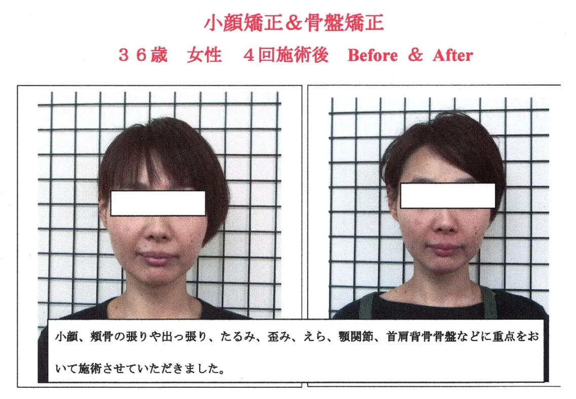 小顔効果を徹底キープ★本格小顔整体+筋膜整体+骨盤整体の写真