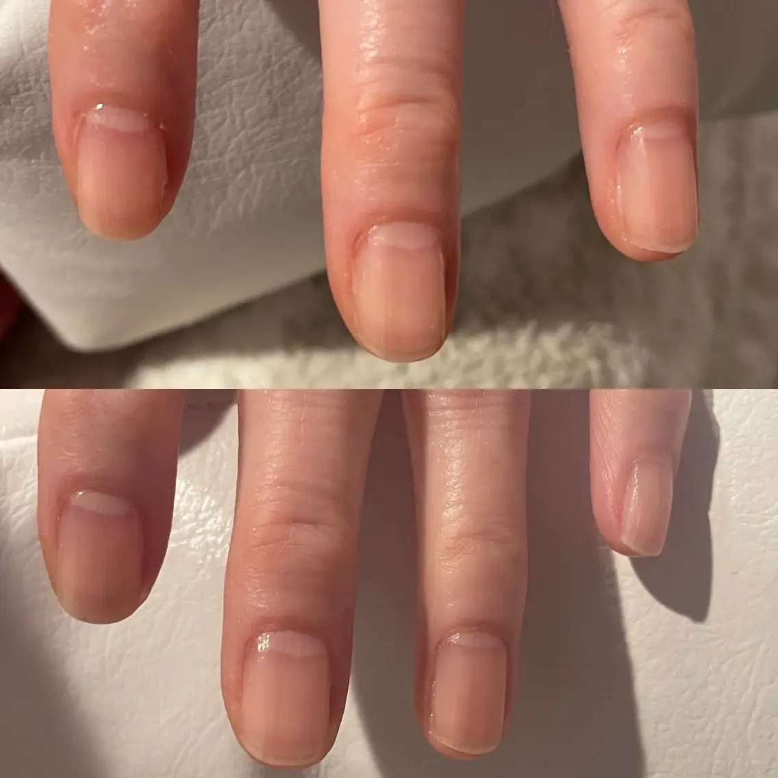 整爪→爪周りの角質ケア→甘皮ケア→保湿パック→マッサージ→保湿の写真