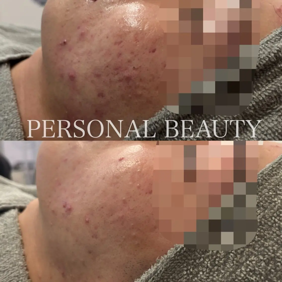 PERSONAL BEAUTY🪻のエステ・リラクイメージ