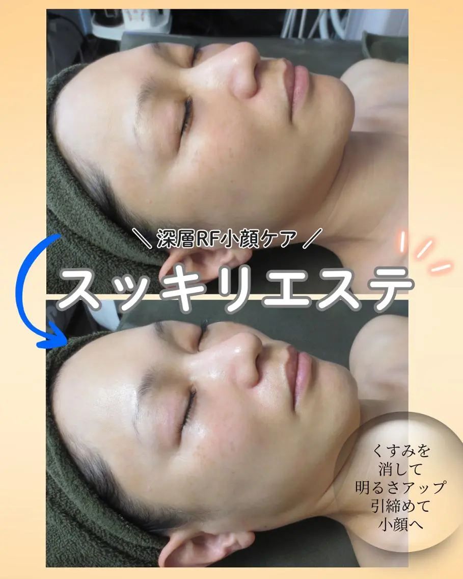 【小顔・引締め・スッキリしたい方】【期間限定】深層小顔ケア90分の写真