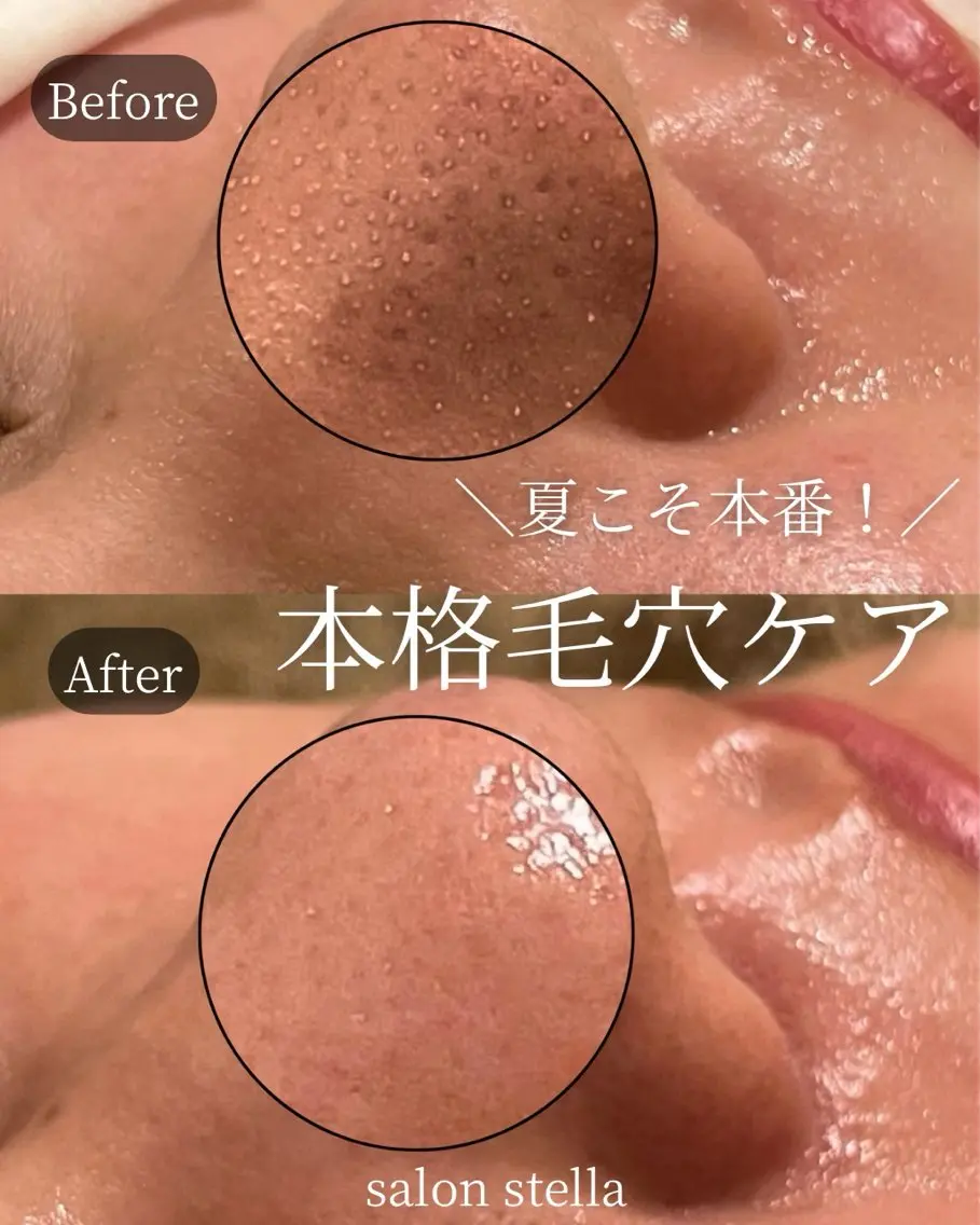 サロンステラ RIKAのエステ・リラクイメージ