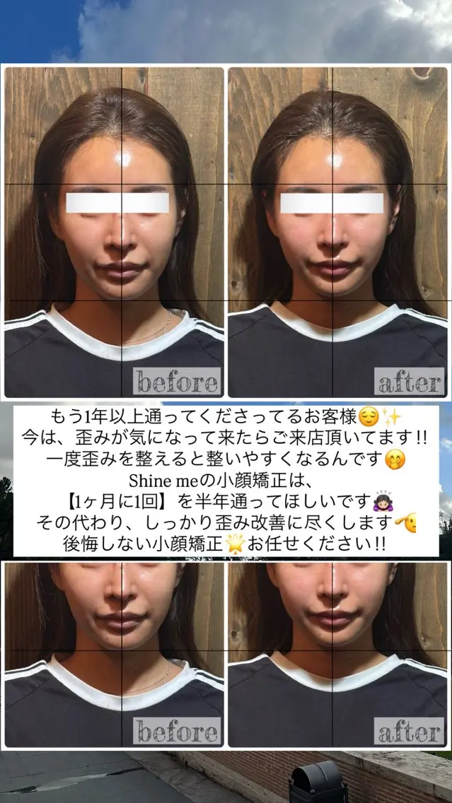エステ リラク 💎後悔させない小顔 矯正💎イトヤマ🌱のエステ・リラクイメージ