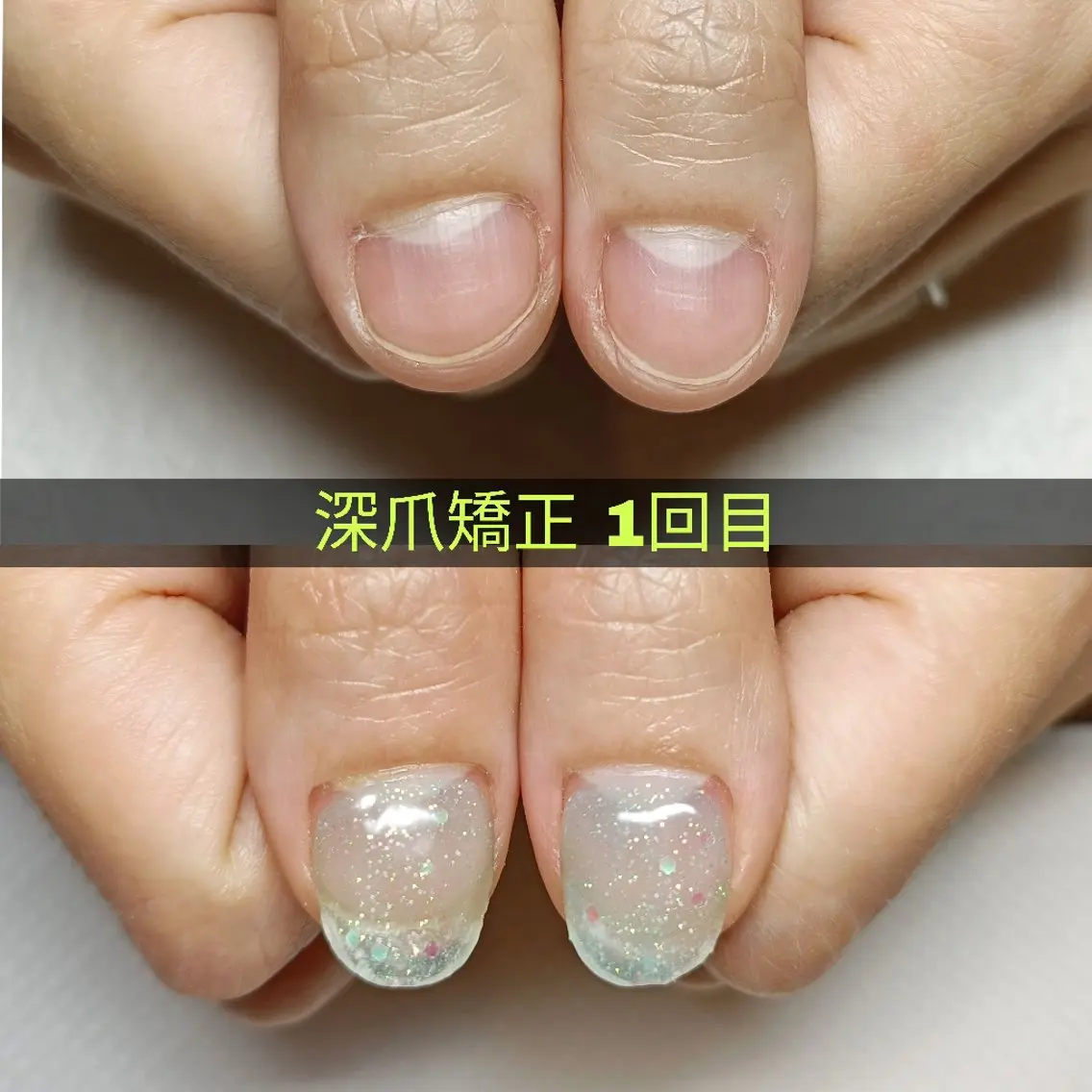 ネイル ハンドネイル ハンドケア 深爪矯正/爪育成ケア manie nailのネイルデザイン
