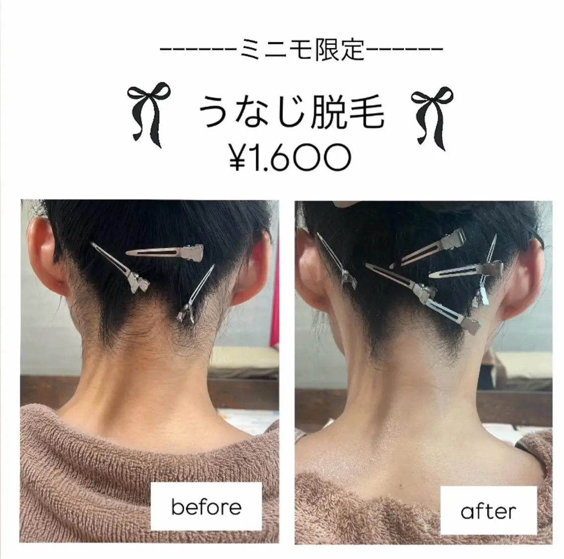 脱毛 「EARTH夢咲店」 谷口のエステ・リラクイメージ