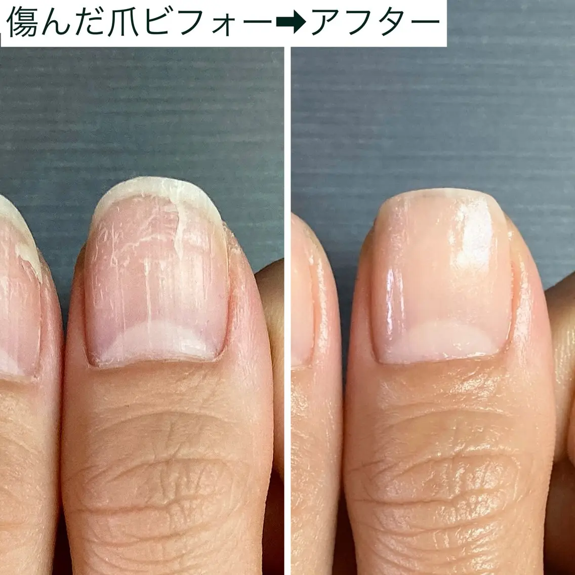 【シンプル綺麗な自爪風】自爪育成ネイルケア＋プロのギタリスト用補強コート仕上げ70分🌿 #深爪 #二枚爪 #噛み爪の写真