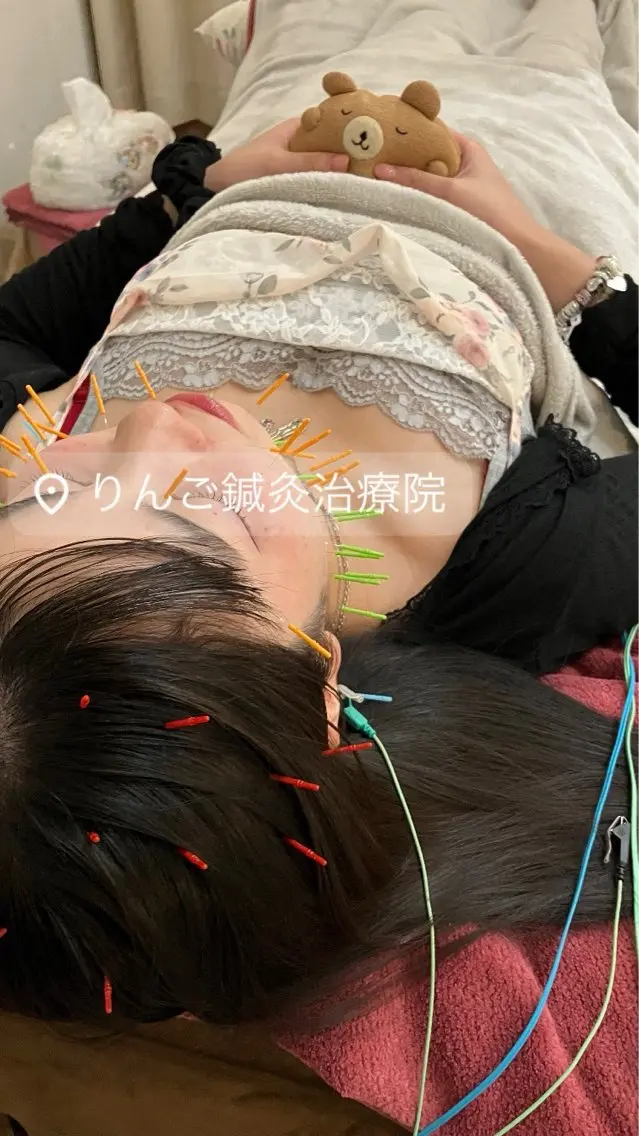 その他 美容鍼灸女性専用 りんご鍼灸治療院のその他イメージ