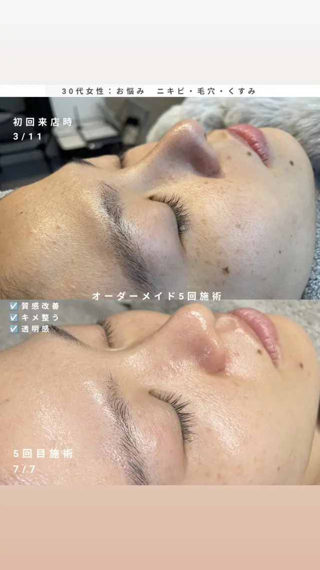 エステ cocofleur 美容看護師監修サロンのエステ・リラクイメージ