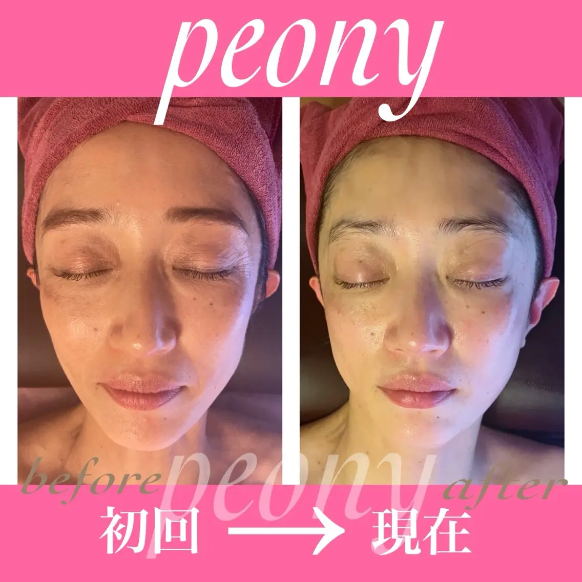 デトックス美容専門 サロンｐｅｏｎｙのエステ・リラクイメージ