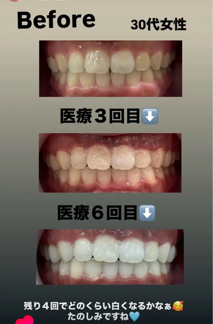 Kaula ホワイトニング🦷✨のエステ・リラクイメージ