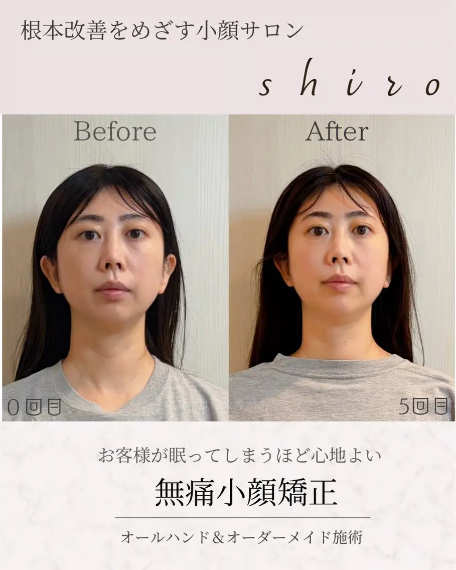 エステ リラク 小顔矯正勝山式 shiroしろのその他イメージ