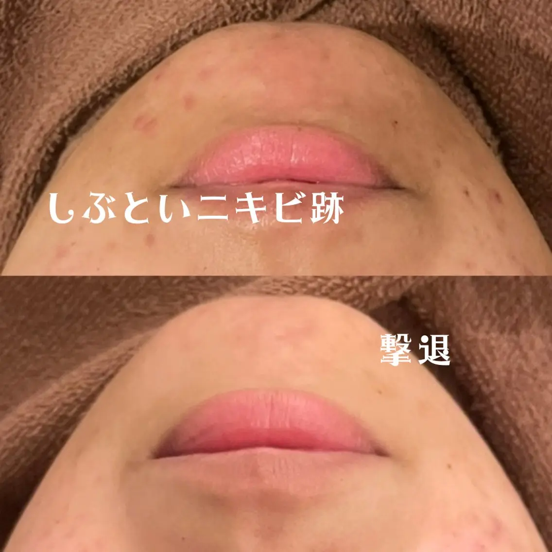 触れたくなる モテ肌へ...❤︎のエステ・リラクイメージ