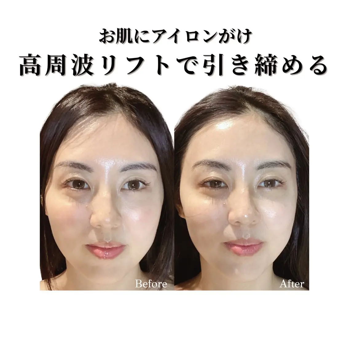 看護師 AYUIのエステ・リラクイメージ
