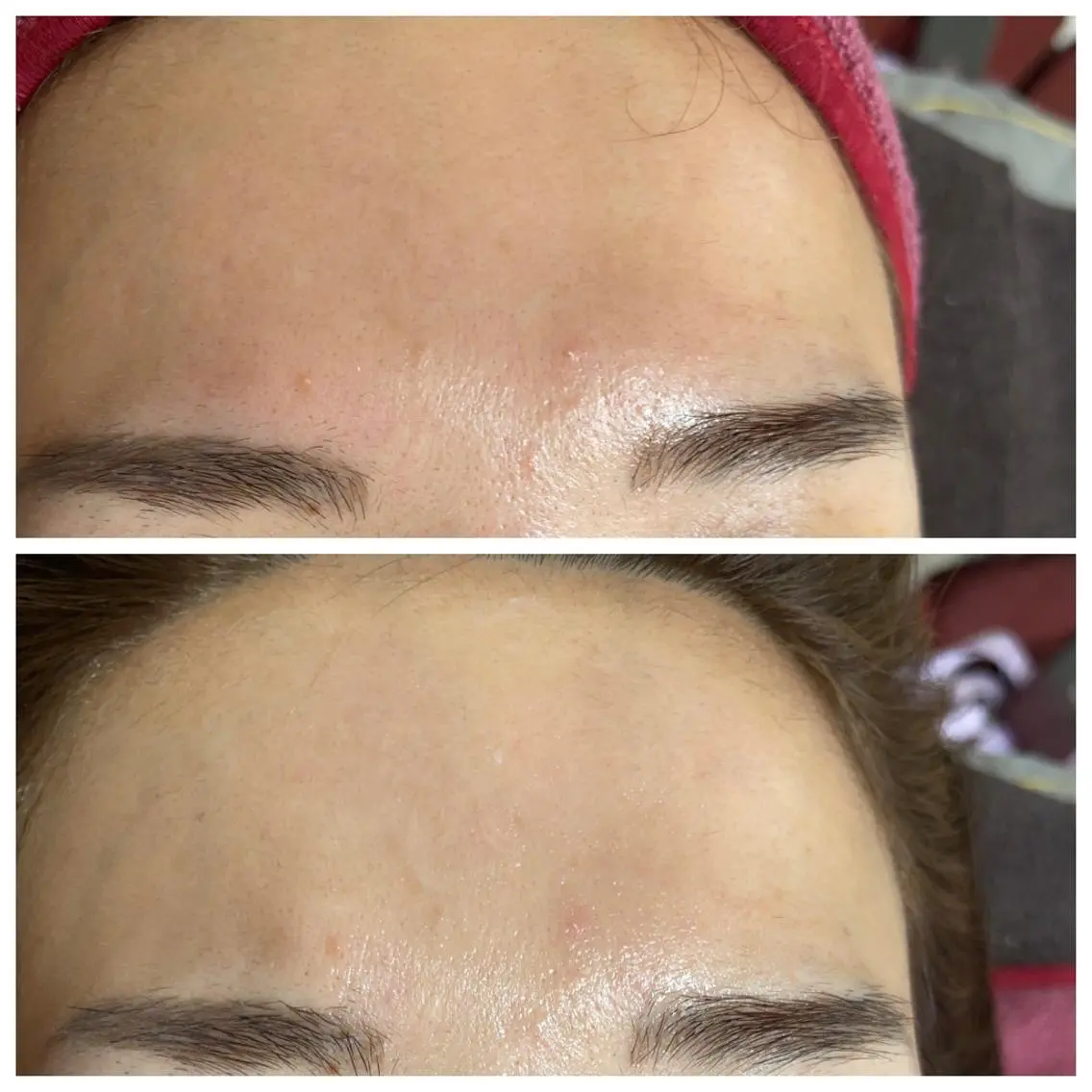 肌質改善サロン facialmoonのエステ・リラクイメージ