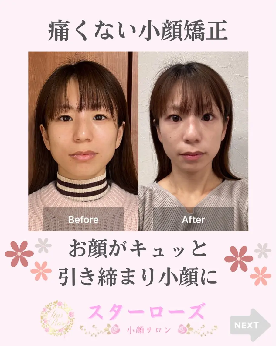 小顔矯正サロン スターローズのエステ・リラクイメージ