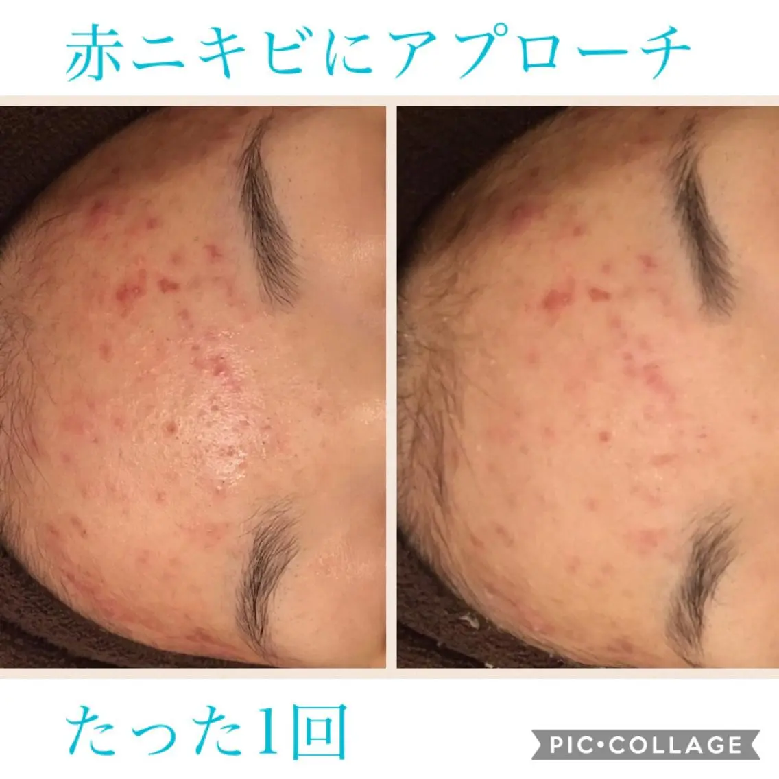 セミロング カラー パーマ ヘアアレンジ キッズ ネイル マツエク・マツパ エステ リラク EnsorClair 代表 野口真央のエステ・リラクイメージ