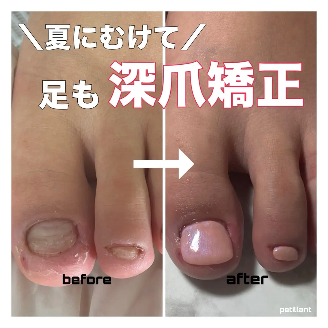 ネイル フットネイル nail salon petillantのネイルデザイン