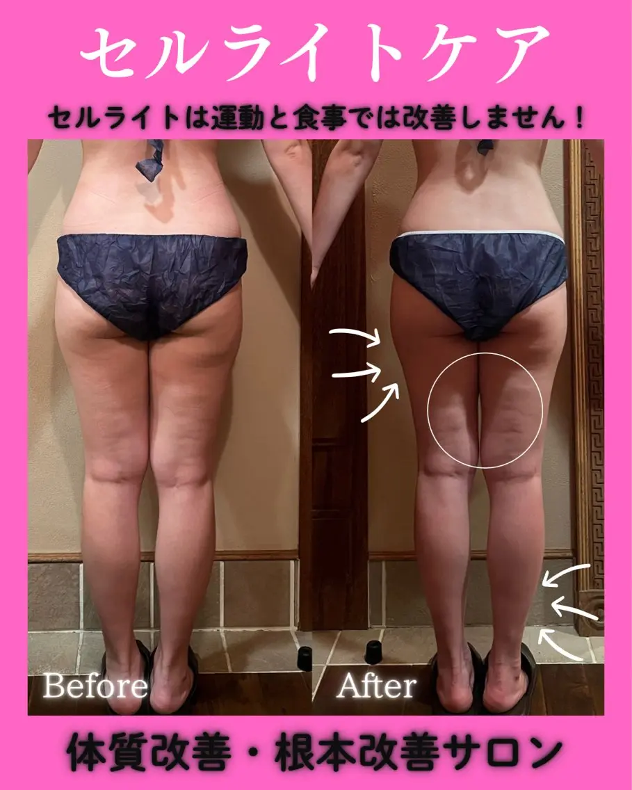 痩身&美肌サロン 堀米✨のその他イメージ