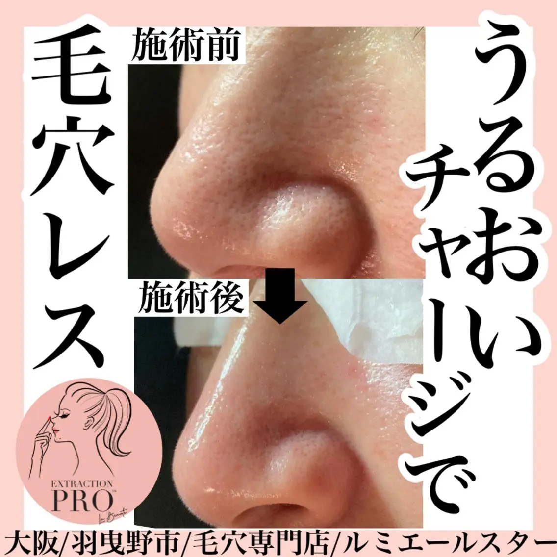エステ 最速 毛穴シミ改善 いくえのその他イメージ