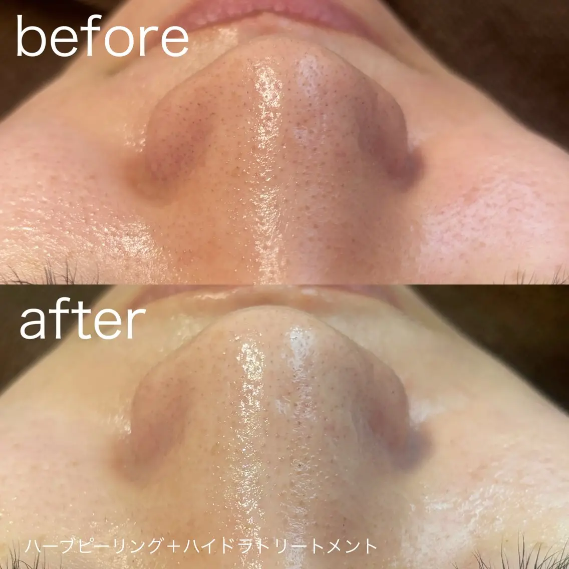 脱毛 lulularico Yuのネイルデザイン