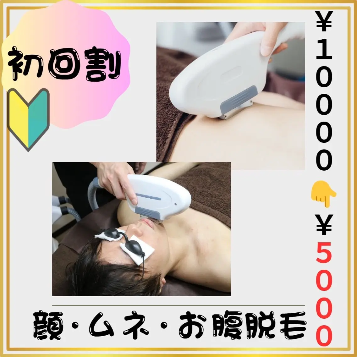 🔰新規割🔰【顔・胸・お腹 脱毛】 5️⃣0️⃣%割引❗️(#メンズ脱毛 #女性ウケ◎  #清潔感  #都度払い)の写真