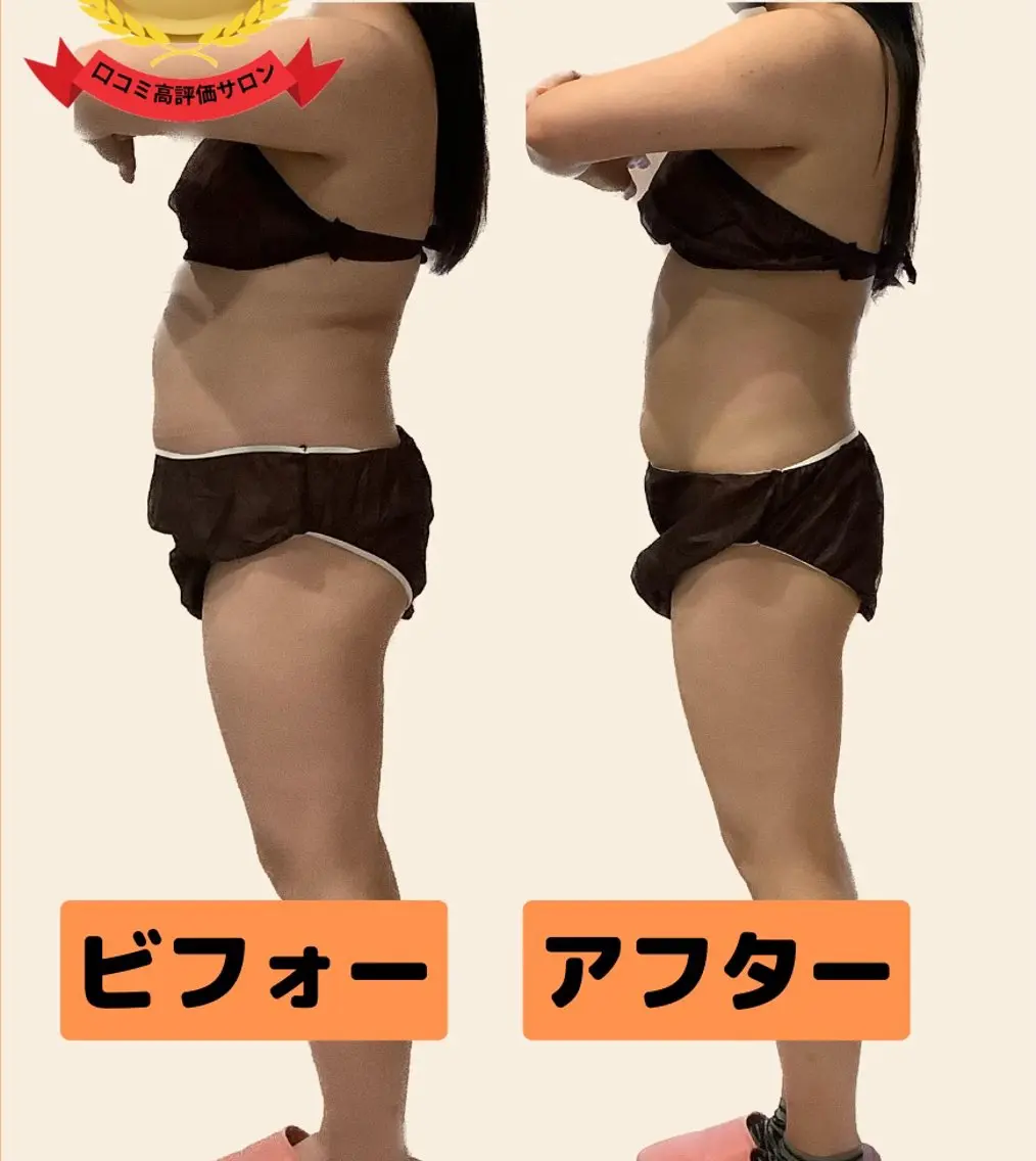 🌟痩身60分🌟美脚❗️太もも＋ふくらはぎ＋お尻＋足首　下半身集中オーダーメイド（キャビ+ラジオ波+吸引/EMS)の写真