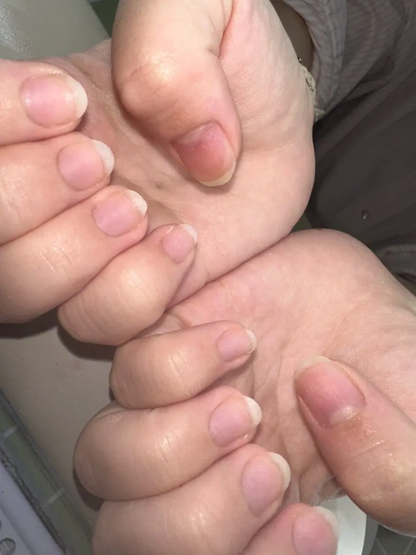 オフのみ✨ Nail removal onlyの写真