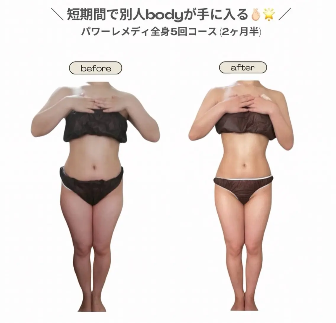 エステ リラク 《本気痩せ×疲労改善 》  BILOOPのエステ・リラクイメージ