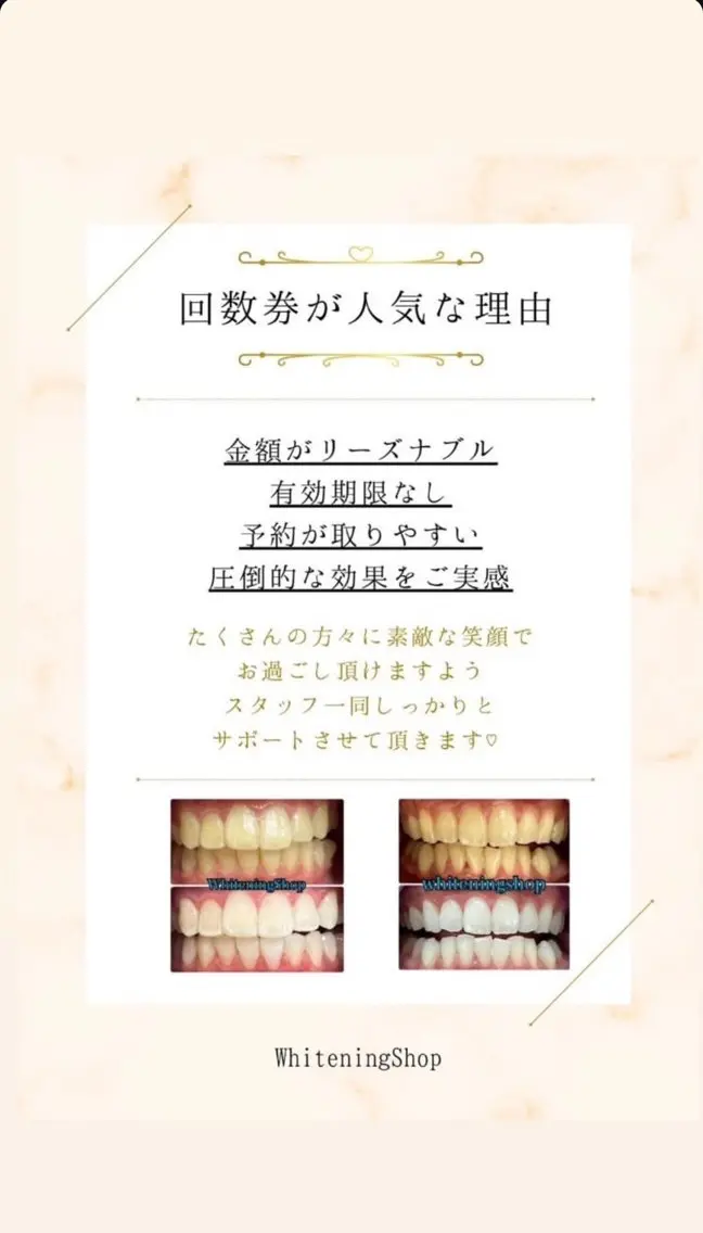 ホワイトニング ショップ伊丹店のその他イメージ
