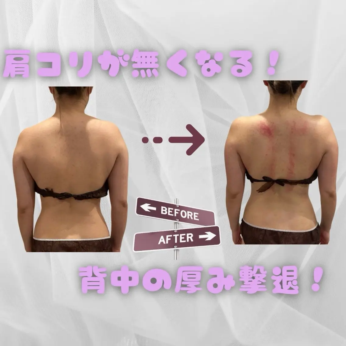 痩身｜美肌サロン 上西のエステ・リラクイメージ