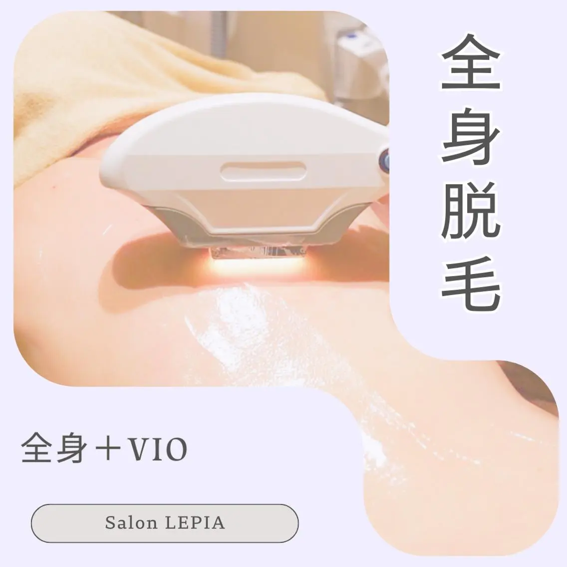 初めての脱毛人気No.2💜全身「VIO込」2回まで格安 ￥22,000→6,600円の写真